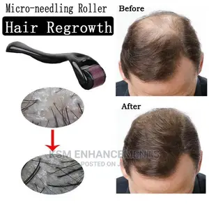 Derma Roller