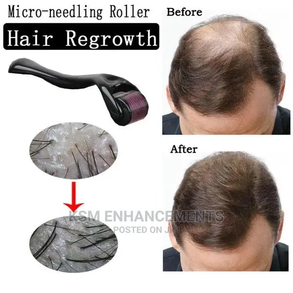 Derma Roller