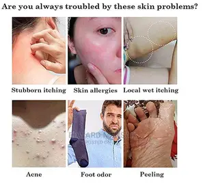 Eczema, Psoriasis