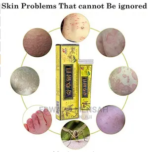 Eczema, Psoriasis