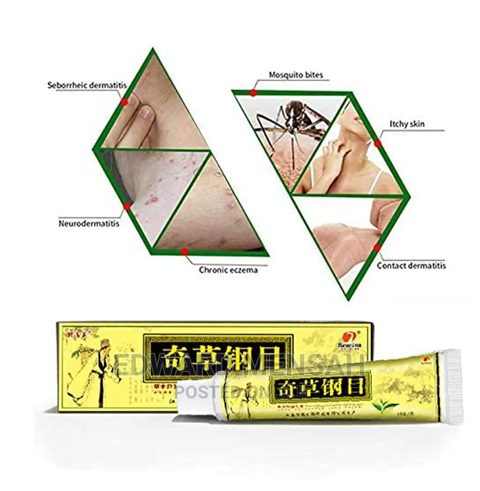 Eczema, Psoriasis