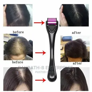 Derma Hair Roller System (0.5mm)