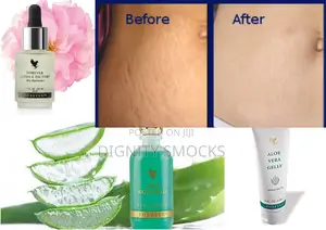 Stretch Marks Remedy