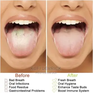 3pcs Tongue Scraper