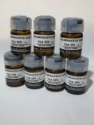 Tca Chemical Peel Solution