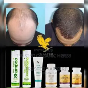 Baldness Or Hair Loss