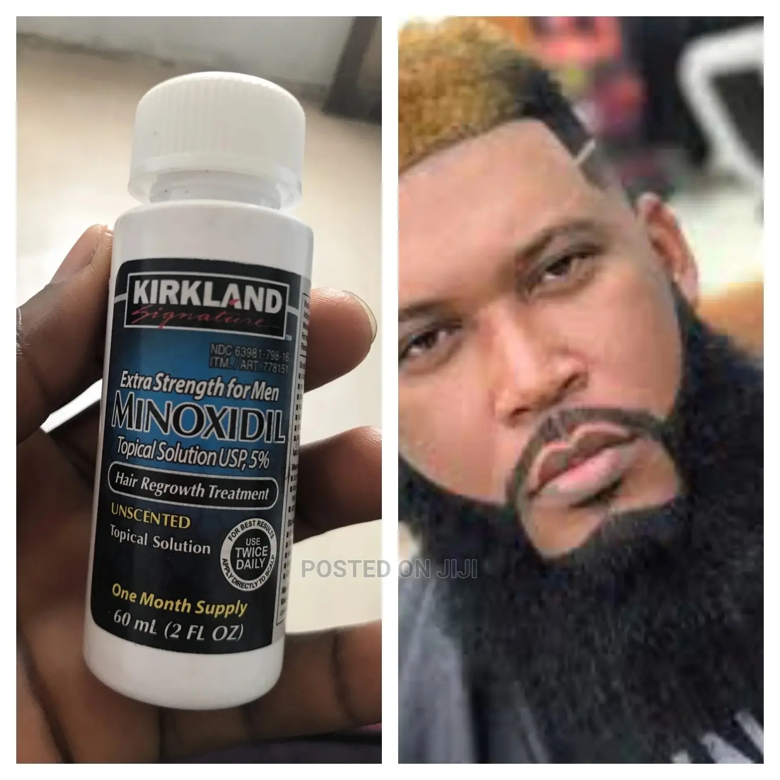 Minoxidil Kirkland Beard Oil