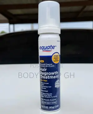 Equate Minoxidil Foam for Receding Hairlines Baldness