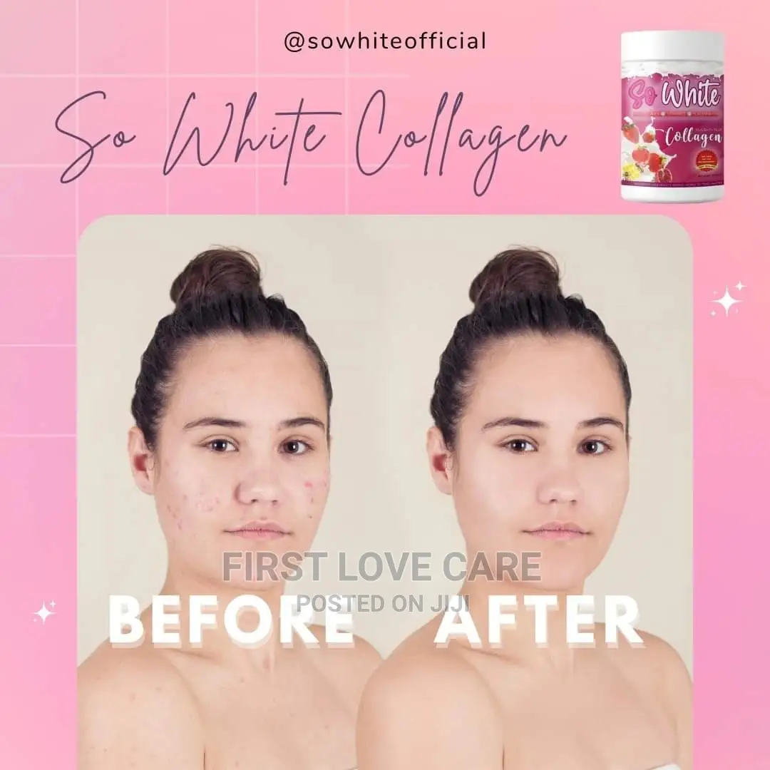 So White Collagen So White Gluta Pearl