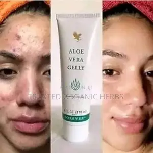 Forever Aloe Gelly - Soothes Clear Gel