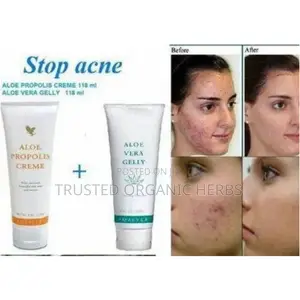 Forever Aloe Propolis Skincare