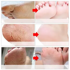Foot Mask / Dead Skin Cells Remover