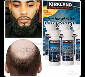Kirkland Minoxibeard