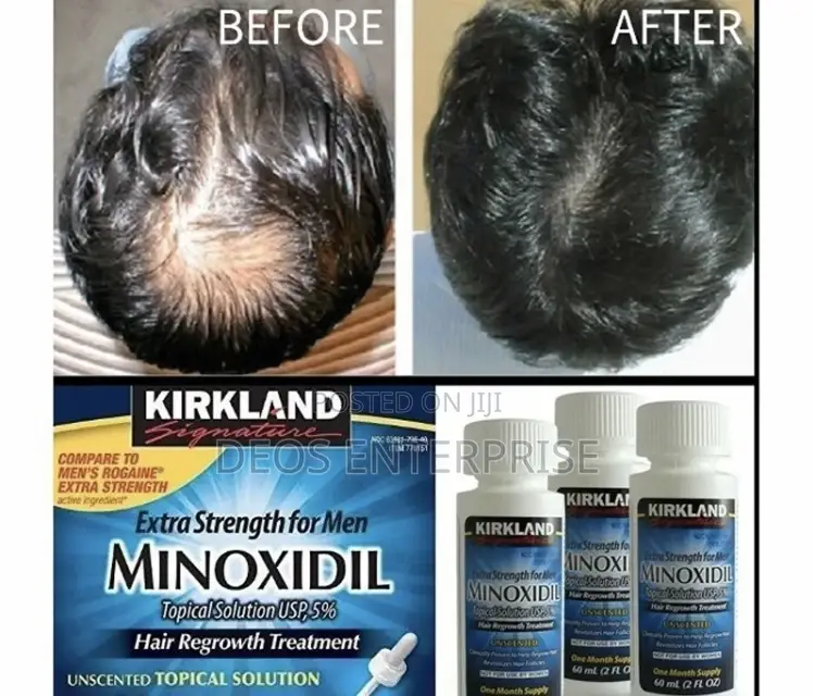 Kirkland Minoxidil