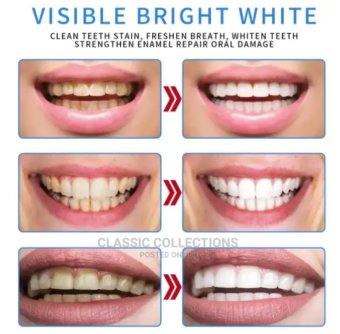 New 5x Whitening Toothpaste by 2 Packs and 1 Pack FREE