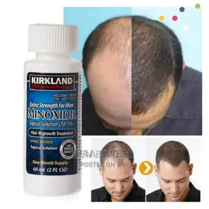 Original Kirkland Minoxidil