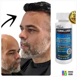 Undiluted Minoxidil