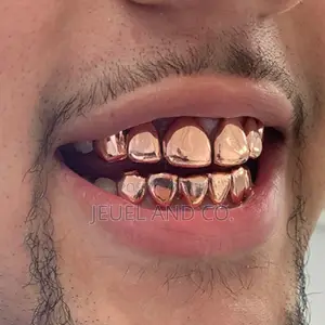 Original Rose Gold Grillz / Slugs