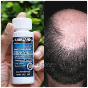 Kirkland Minoxidil (Original 100%)