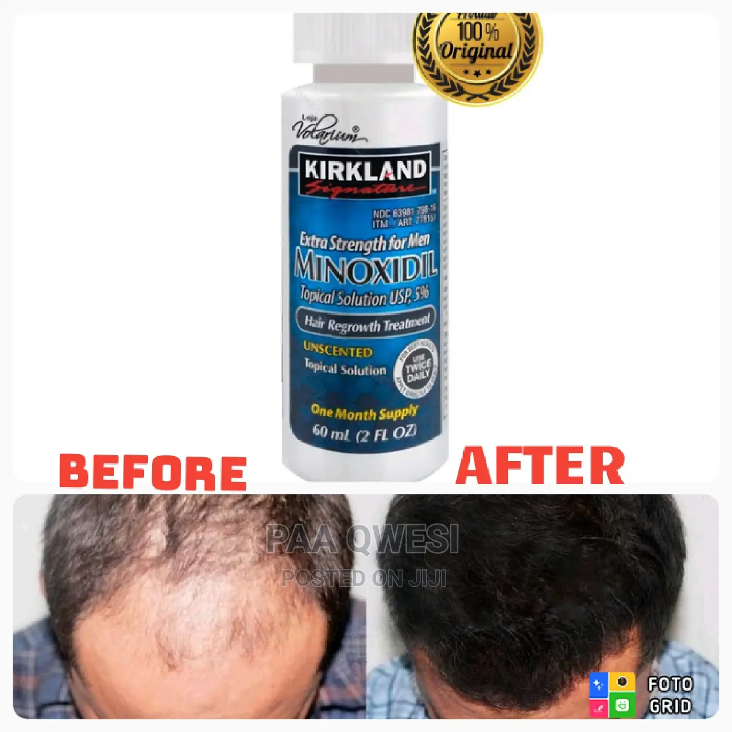 Kirkland Topical Solution.