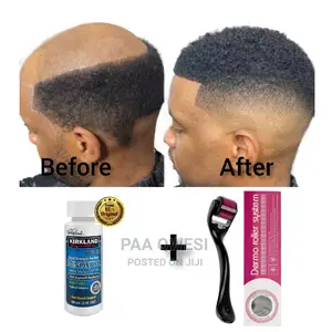 Derma Roller System Kirkland Undiluted Oil