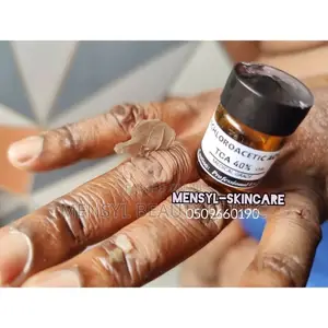 Tca Chemical Peel Solution