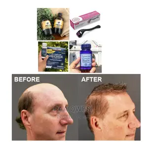 Jaimaca Castor Oil,Biotin,Derma Roller Kirkland{Utra}