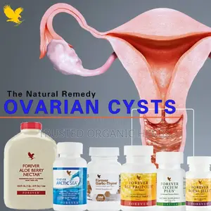 Natural Solution for Ovarian Cyst