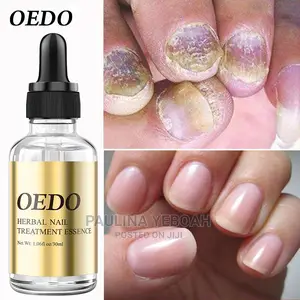 Nail Treatment Oil