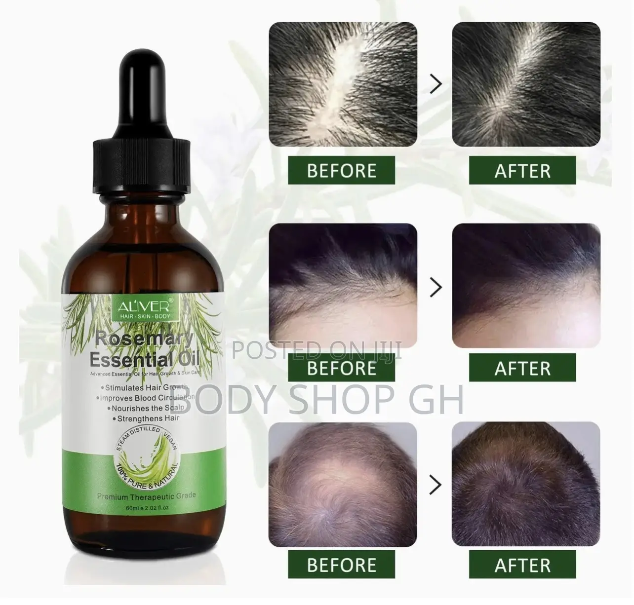 Rosemary Oil for Hair and Edges Growth - Reduce Hair Loss