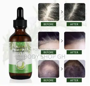 Rosemary Oil for Hair and Edges Growth - Reduce Hair Loss