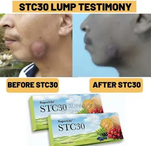 STC30 Medicinal Supplements