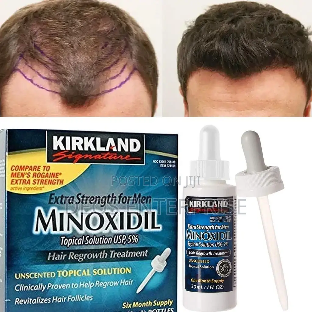 Kirkland Minoxidil Oil for Baldness