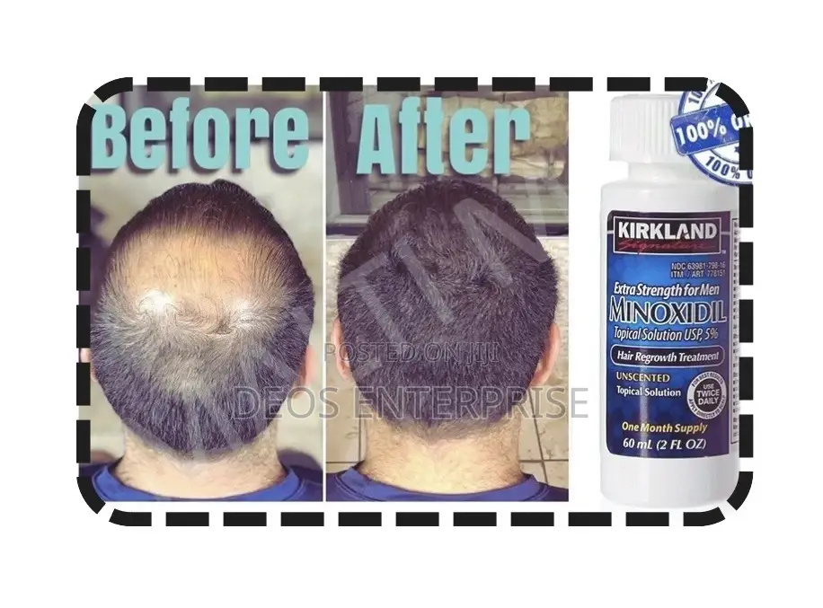 Kirkland Minoxidil Extra Strength for Beard Growth