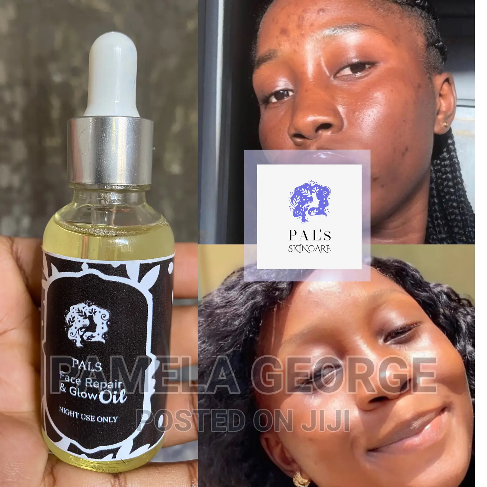 Face Repair Oil for Dark Spots and Pimples