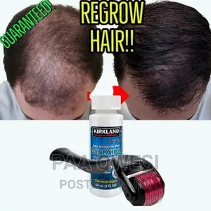 Men Hair Regrowth Product