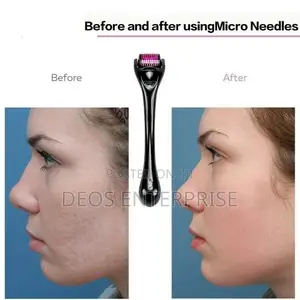 Derma Roller for Skin