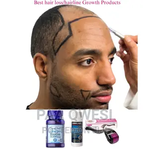 Rapid Hair Loss /Hairline Regrowth Products(Men)