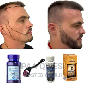 Hairline Loss Full Beard Growth Product {100% Guaranteed}