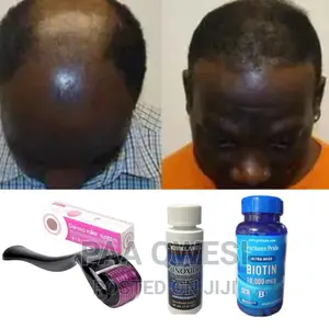“Kirkland Minoxidil:The Ultimate Haircare Secret”
