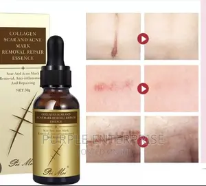 TCM Scar Removal Oil