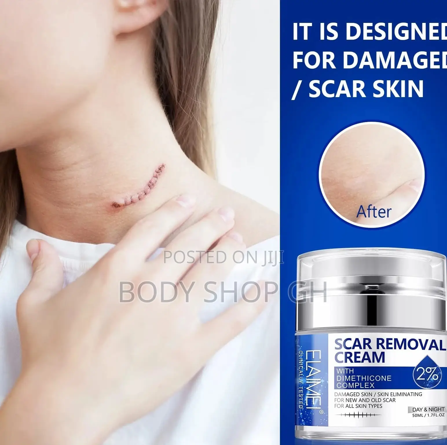 Scar Removal Cream - Advanced Scar Treatment Gel