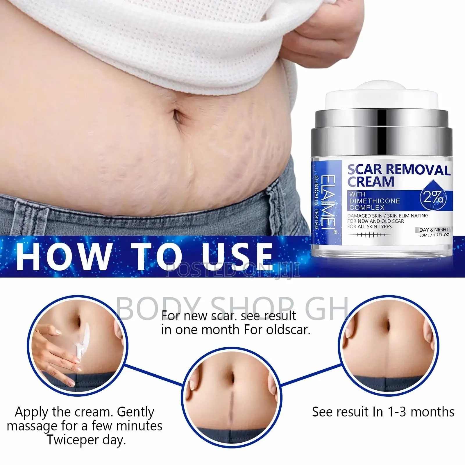 Scar Removal Cream - Advanced Scar Treatment Gel