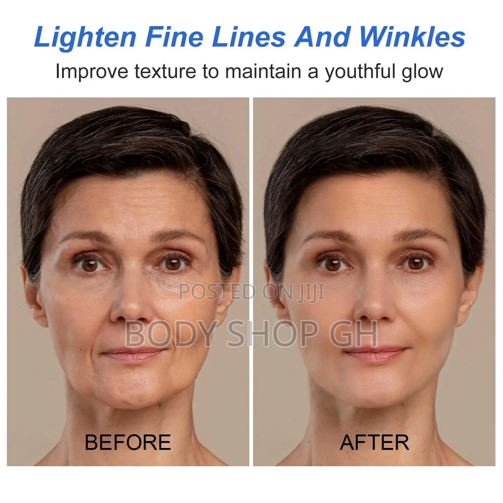 Botox Stock Solution Anti-Aging Serum [ Prevent Wrinkles ]