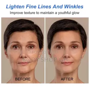 Botox Stock Solution Anti-Aging Serum [ Prevent Wrinkles ]