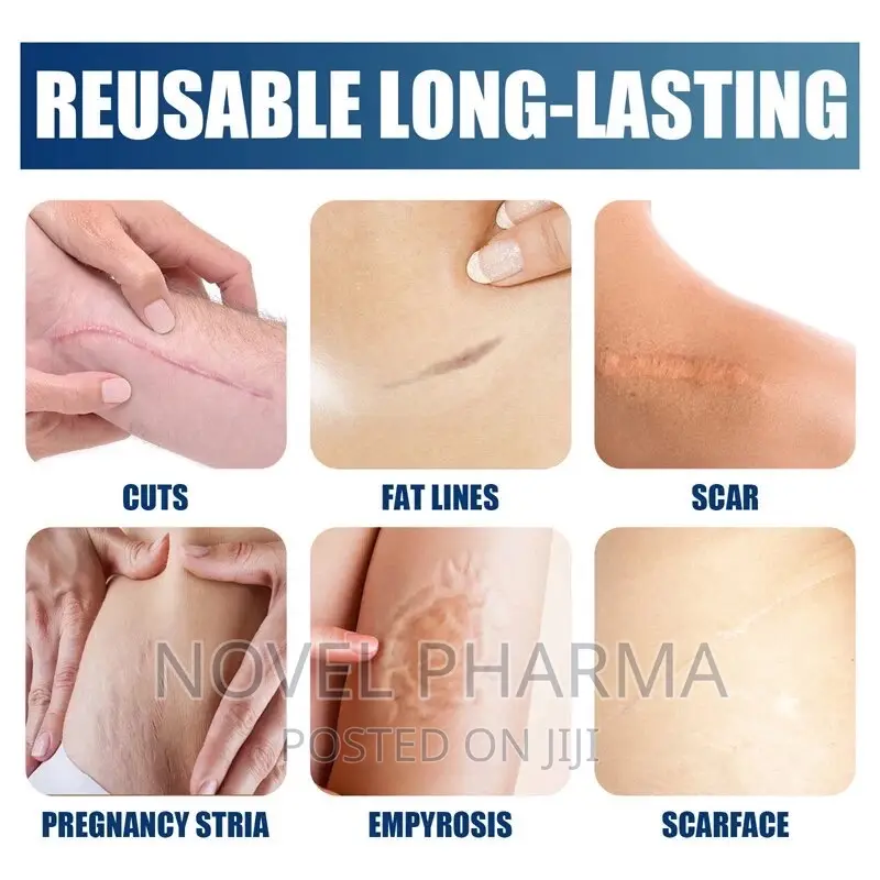 Silicone Scar Gel - 30g