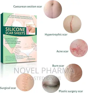 Silicone Scar Sheet