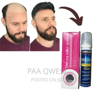 Super Combo for Baldness and Hairline Loss