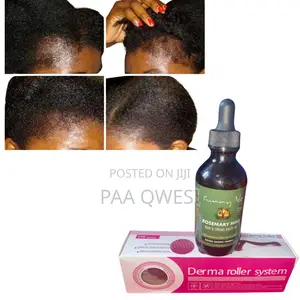 Rosemary Mint and Derma Roller
