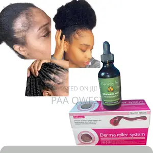 Derma Roller 1.5mm Rosemary Oil for Hair Edges